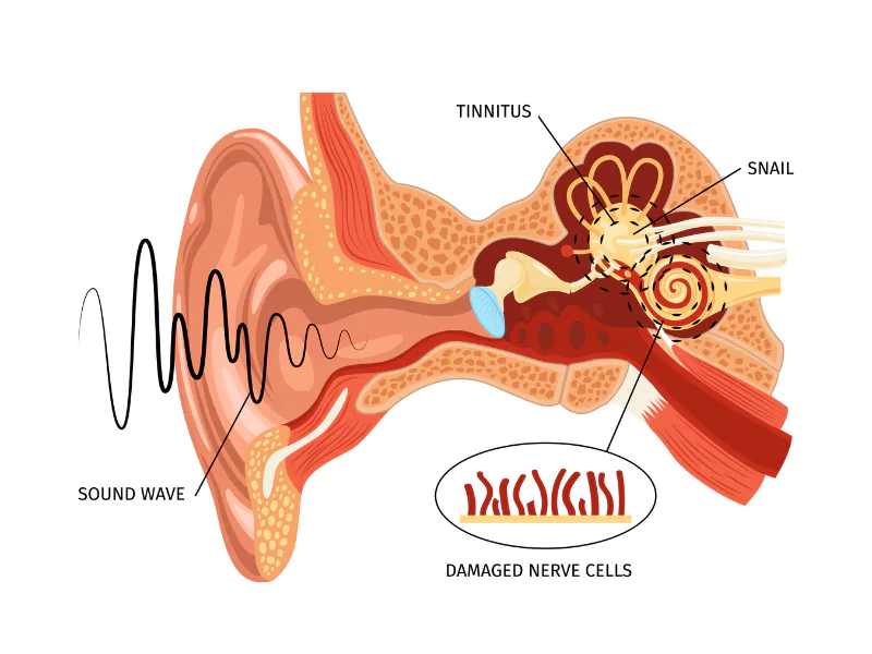 The image shows how the sound reaches the brain The image shows how the sound reaches the brain<br />